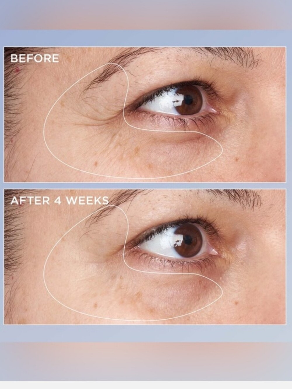 Perricone MD Triple Retinol Renewal Eye Serum - New In Box - Picture 2 of 4